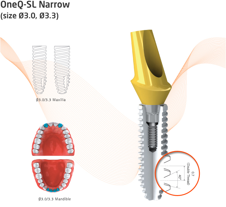 s-clean-Narrow